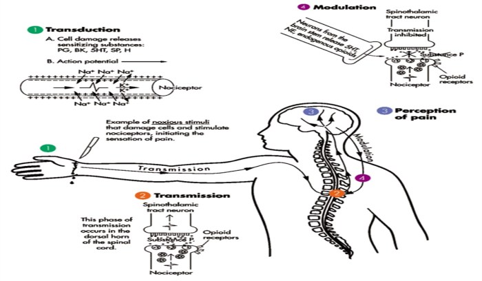 What is nociceptive pain