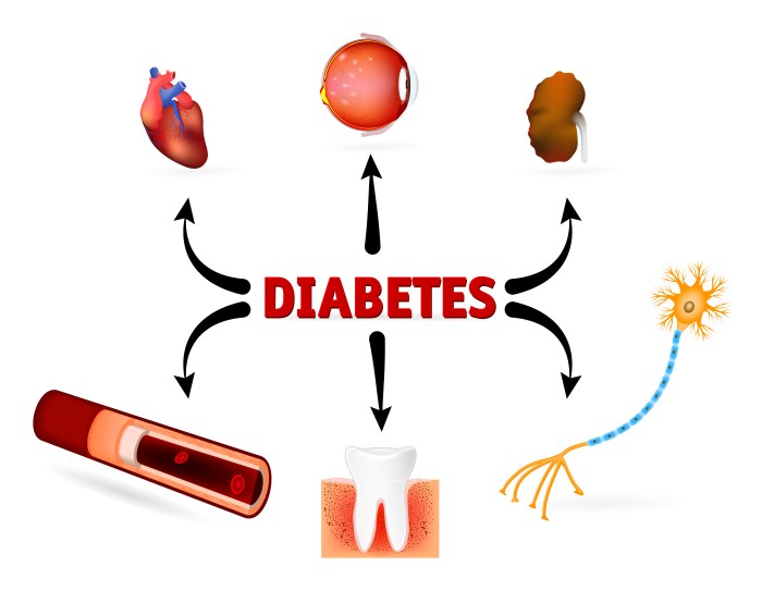 How to Fix Type 2 Diabetes with Functional Medicine Diabetes nutrition and weight loss