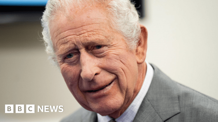 Adenosis enlarged breast lobules