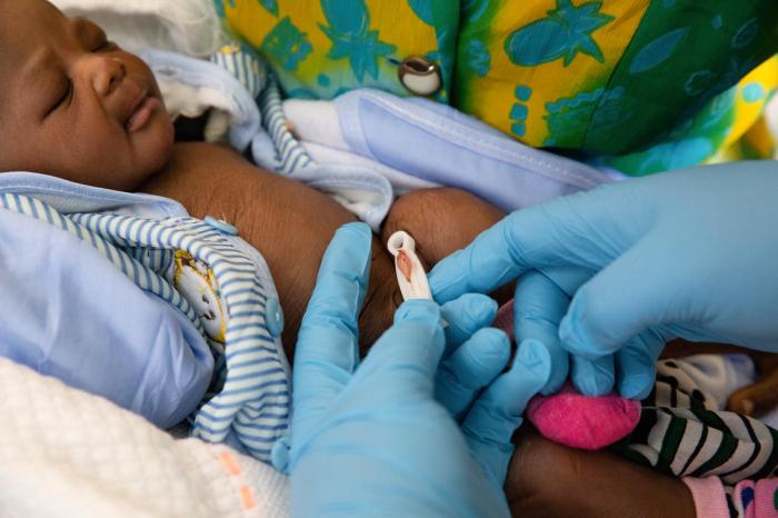 Umbilical cord compression signs and complications