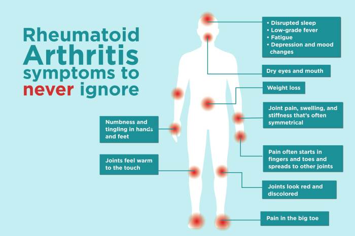 Symptoms of Rheumatoid Arthritis Flares A Deep Dive