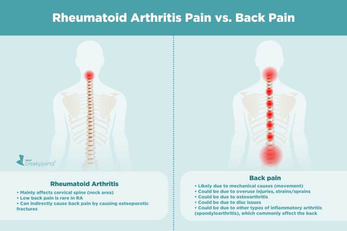 Causes of Rheumatoid Arthritis Pain Aside from Inflammation Rheumatoid arthritis back pain