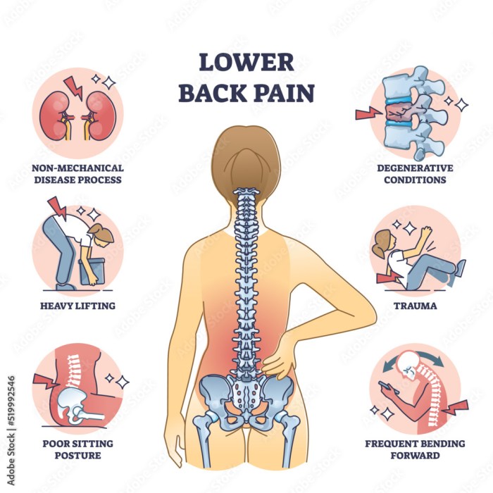 Arthritis in back treatment