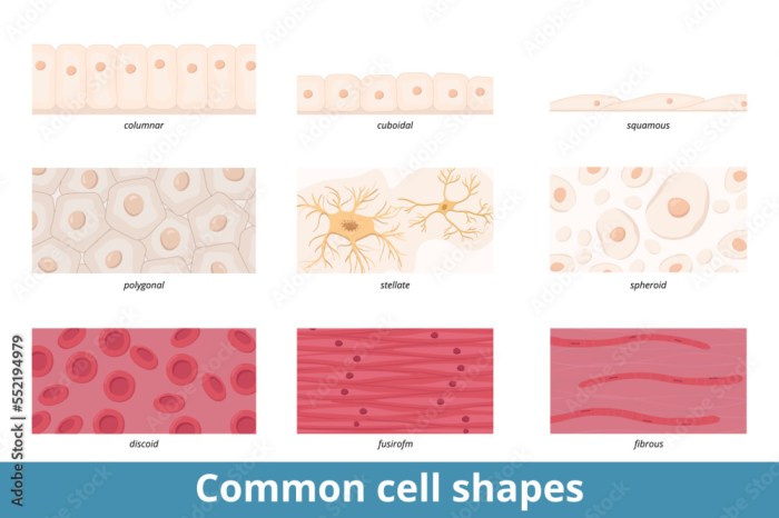 Small-cell vs. squamous-cell lung cancer | Pathology Student What are squamous cells