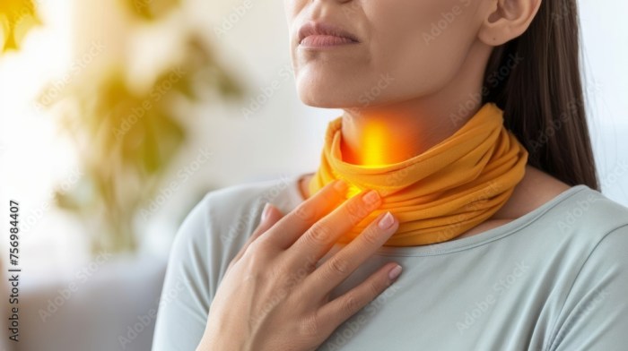 What is barretts esophagus