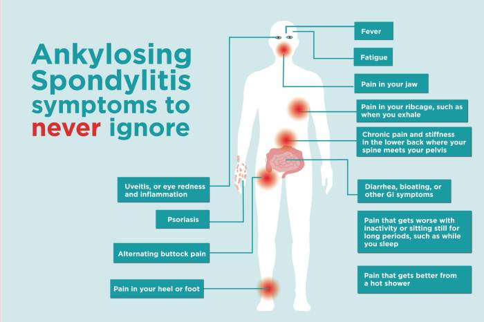 Ankylosing Spondylitis and Teeth Problems A Deep Dive