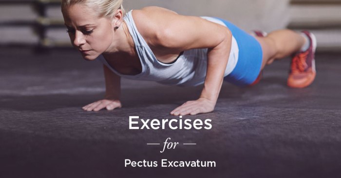 Physical Therapy for Pectus Excavatum A Deep Dive
