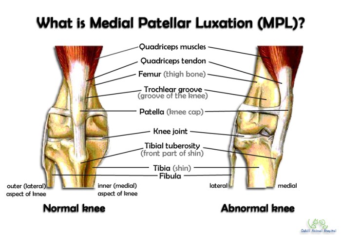 Anatomy of Patella | Bone and Spine Patella anatomy function and treatment