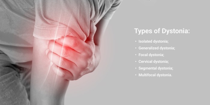 Dystonia vs dyskinesia in parkinsons
