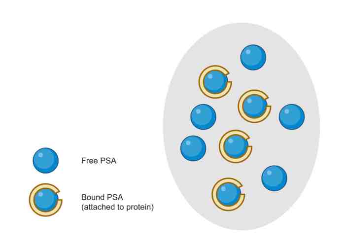 About the PSA Test | PCFA Understanding your psa results