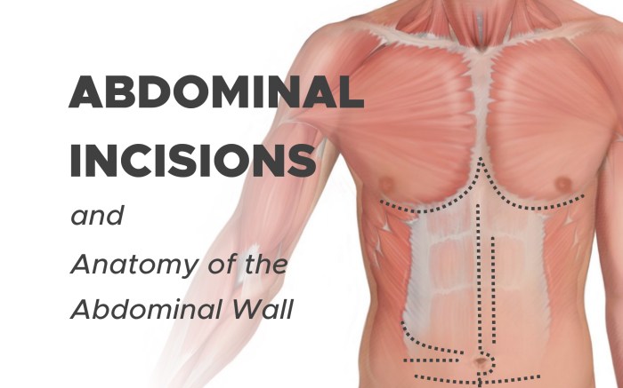 Abdominal Swelling and Bloating Understanding the Causes