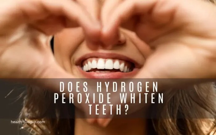 Does Hydrogen Peroxide Whiten Teeth? A Deep Dive