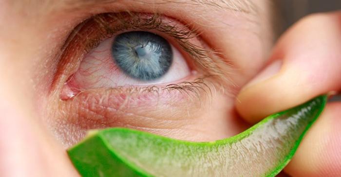 How to cure dry eyes