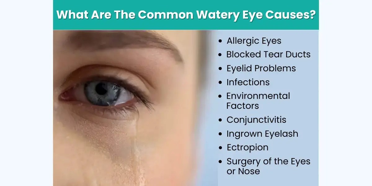 What causes watery eyes