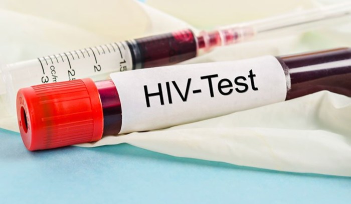 Young women and girls face higher HIV risk — UN report - The New Times Ask an expert hiv support groups