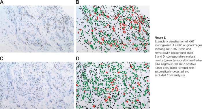 Ki 67 tumor marker test