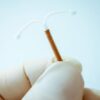 IUD Use in Nulliparous Women A Deep Dive