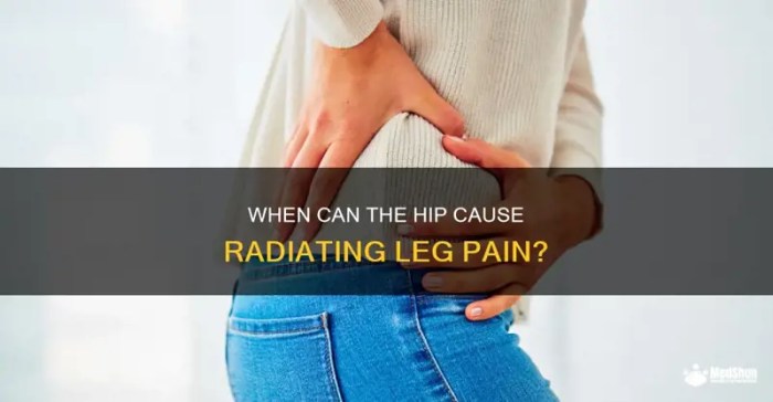 When Can The Hip Cause Radiating Leg Pain? | MedShun Hip pain that radiates