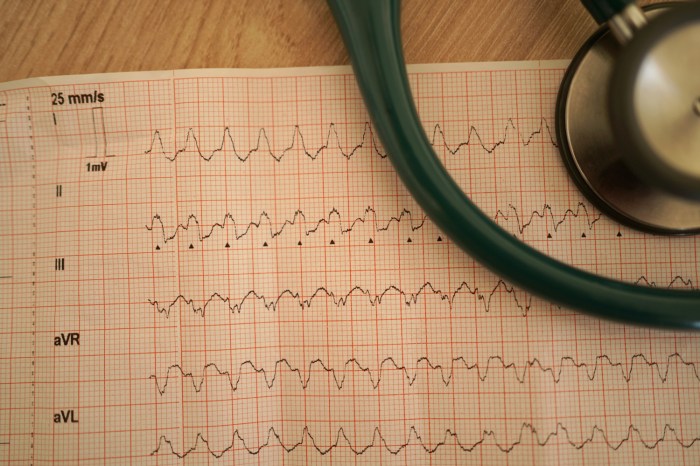 When To Go to the Hospital for Rapid Heart Rate - BuzzRx Hospital rapid heart rate