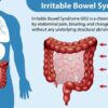 Facts About Irritable Bowel Syndrome A Deep Dive