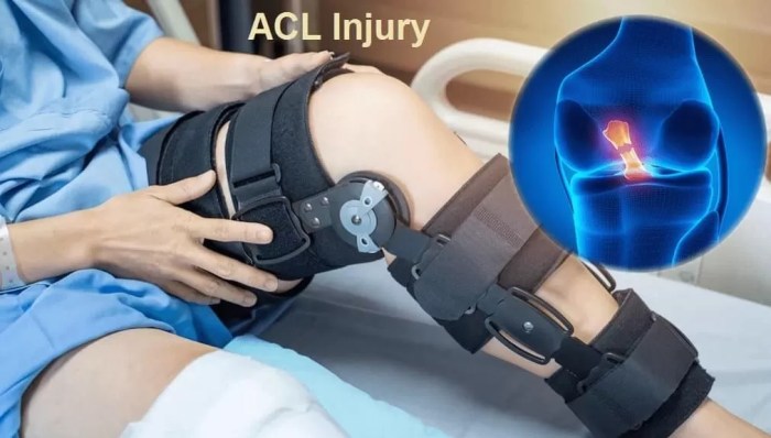 2D and 3D MRIs provide reliable measurements for planning ACL surgery ... Acl surgery making a decision