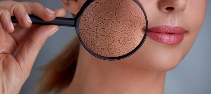 Types of skin lesion pictures causes and treatment