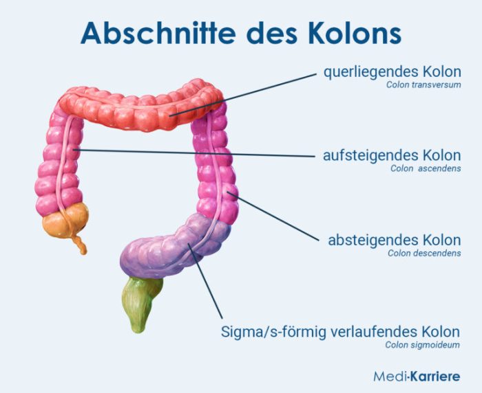 Treatment of colon cancer