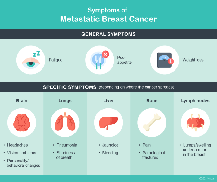 Metastatic breast cancer care team