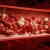 Blood Clots in Urine A Guide