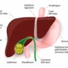 Gallbladder Disease Causes and Risk Factors