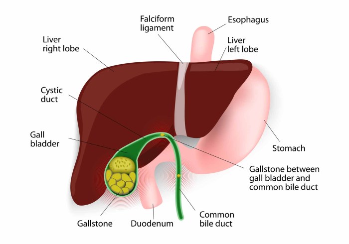 Gallbladder disease causes and risk factors