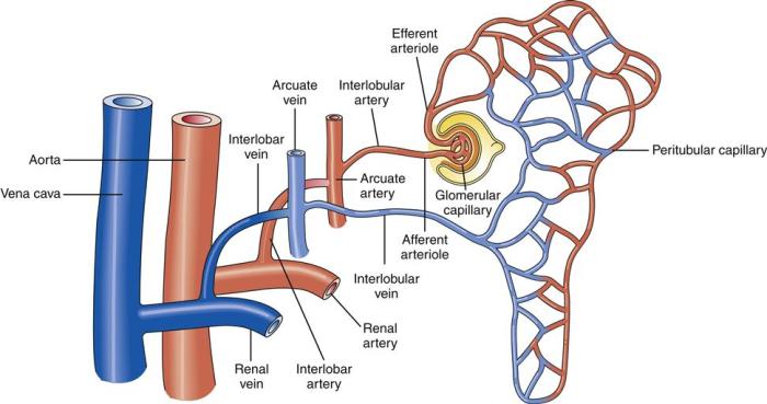 What is renal artery stenosis