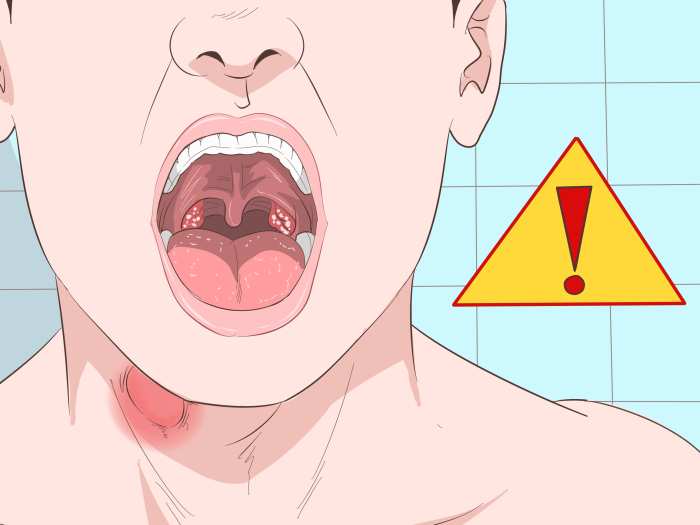 Most cases of sore throat can be treated at home and are caused by ... Sore throat no fever causes and treatment