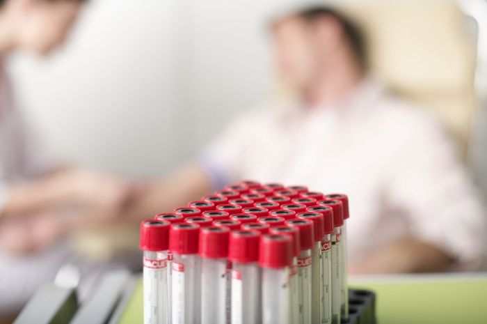 How to Interpret RAST Test Results