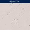 Hyaline Casts in Urine A Deep Dive
