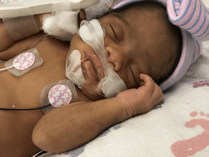 Nkem osian uterine fibroid story