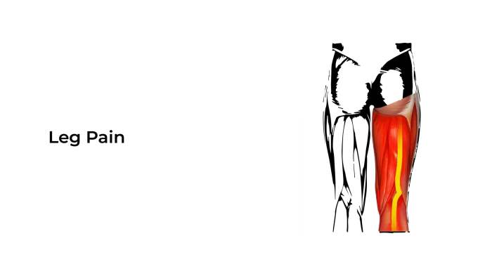 Causes of Lower Leg Pain A Comprehensive Guide