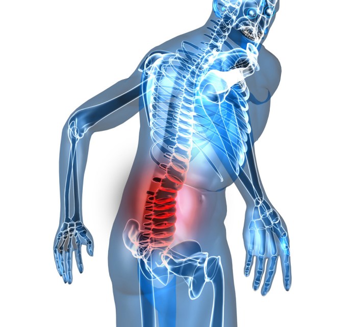Arthritis in back treatment