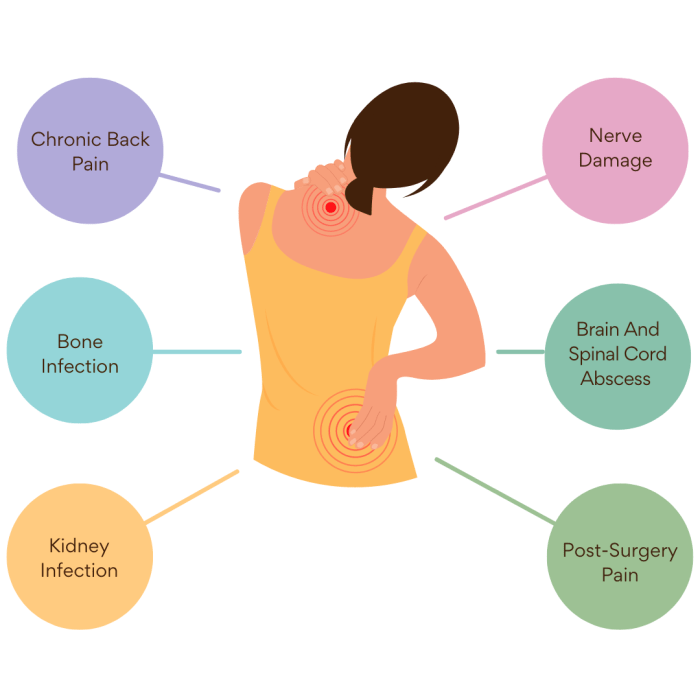Pain in back of knee when walking