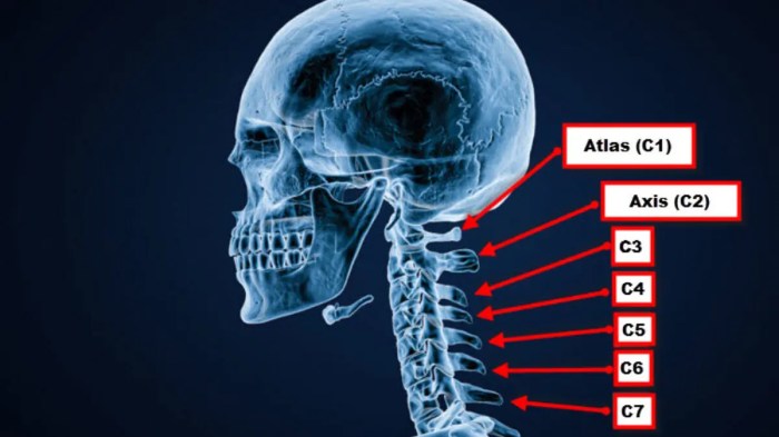 Neck arthritis exercises to avoid