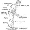 Gait Training in Physical Therapy A Comprehensive Guide