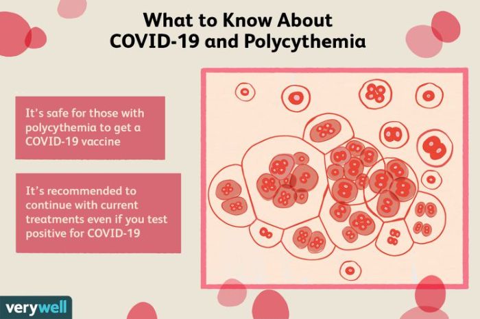 Does the COVID-19 Vaccine Affect Polycythemia Vera? Polycythemia and coronavirus covid 19 risks complications considerations