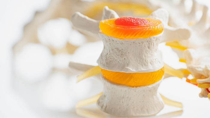 Preventing degenerative disc disease
