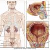 Prostate Cancer Survival Rate A Comprehensive Guide