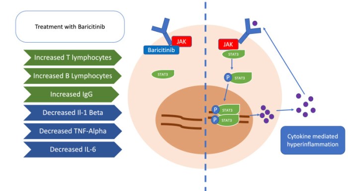 Baricitinib could delay progression of type 1 diabetes