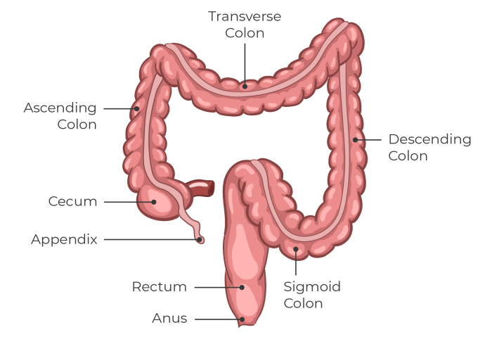 How is colon cancer is detected | Surgical Options Colonoscopy nejm study controversy