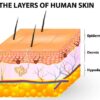 What are Skin Tag Patches? A Comprehensive Guide