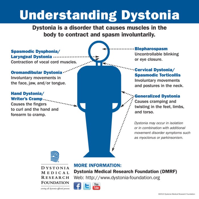 What is Dystonia? Dystonia Awareness Week 2014 - Doctor Scott Health Blog Dystonia vs dyskinesia in parkinsons