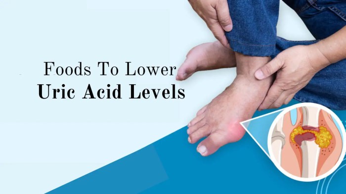 How to reduce uric acid