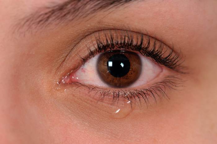 What causes watery eyes